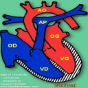 Principales cardiopathies en images